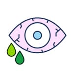 Thick white, yellow, or green discharge.