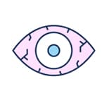 Red or Pink color in the whites of the eyes